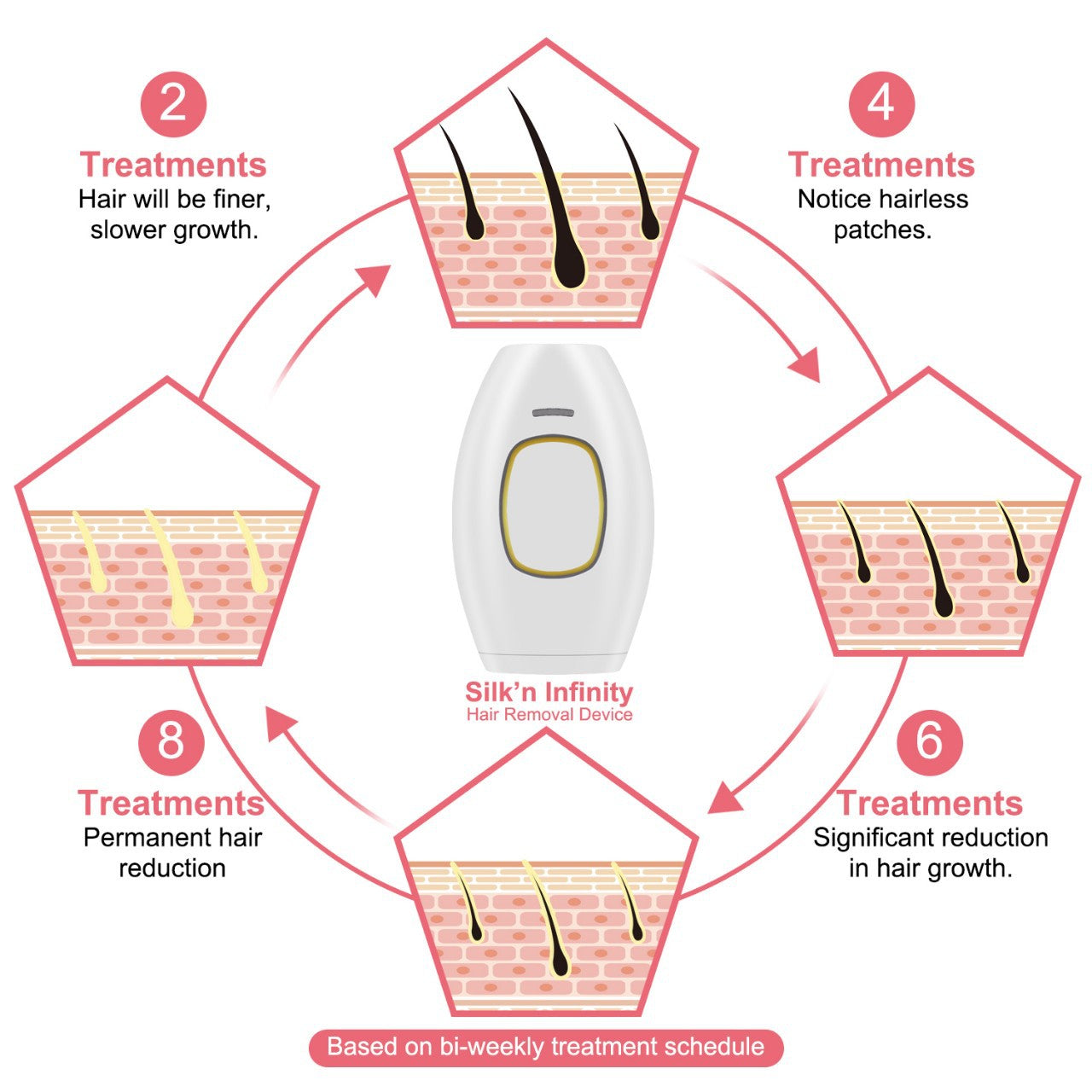Lissiva IPL Laser Hair Removal Handset - Safe, Painless Laser Hair Removal